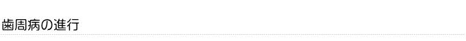 歯周病の進行